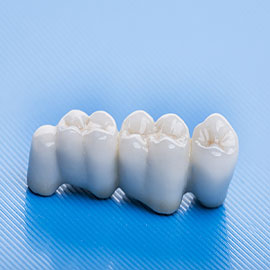 Dental Implant Care