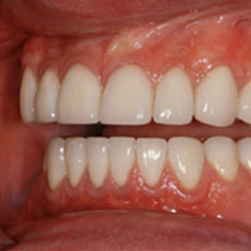 Cosmetic Dentistry